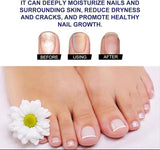 Ginger Nail Treatment Nail Support Nail Care