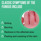 Tea Tree Oil Foot Sanitizer Spray for Dry Cracked Feet, Nail Fungus, Jock Itch, Ringworm, Cracked Heels, and Itchy Skin | Foot Spray
