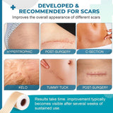 Professional Silicone Scar Sheets (1.6" x 120" Scar Roll-3M) - Scars Removal Treatment - Reusable Silicone Scar Tape Strips Type for Keloid, C-Section, Surgery, Burn, Acne et